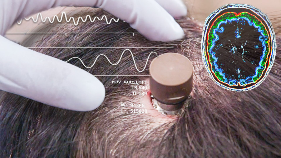 A doctor checking a neural ink implant on the patient's head